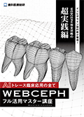 インビザライン契約数が爆増!WEBCEPH完全攻略の超実践編 AIトレース臨床応用の全て「WEBCEPHフル活用マスター講座」 -WEB動画サービス-(郵送B)