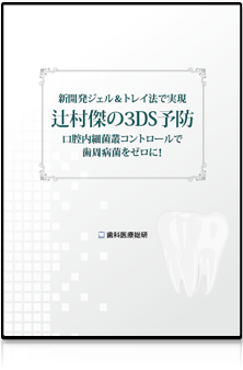 新開発ジェル＆トレイ法で実現 辻村傑の3DS予防