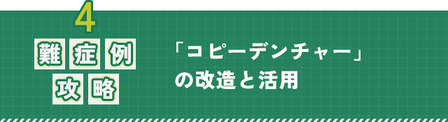 4.【難症例攻略】「コピーデンチャー」の改造と活用