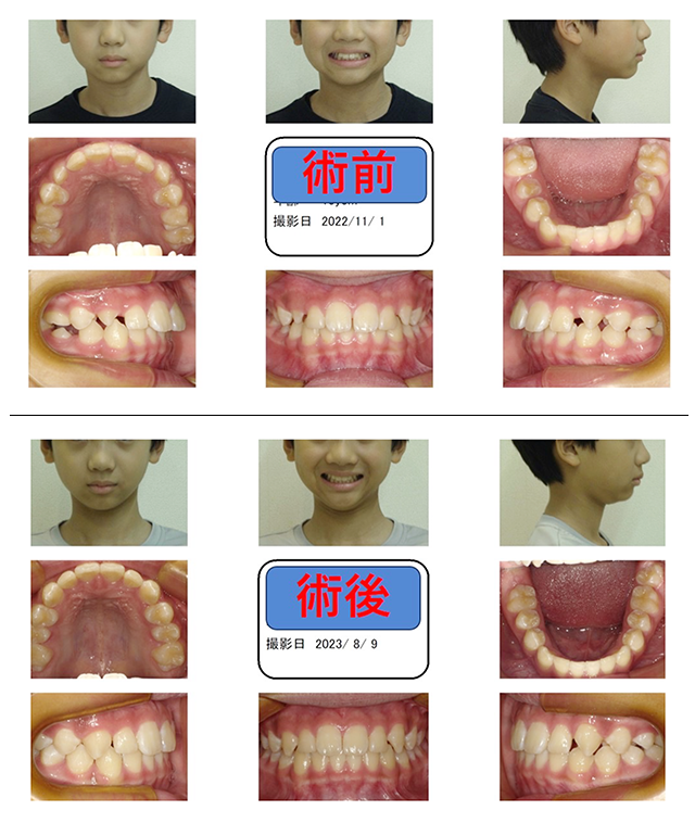 術前術後