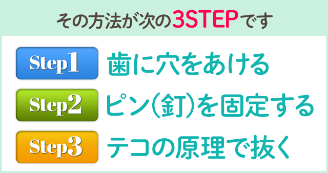 その方法が次の3STEPです。STEP1　歯に穴をあける　STEP2　ピン（釘）を固定する　STEP3　テコの原理で抜く