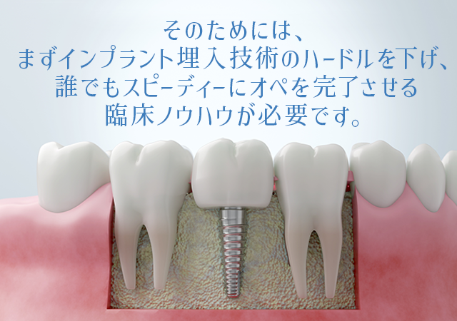 そのためには、まずインプラント埋入技術のハードルを下げ、
誰でもスピーディーにオペを完了させる臨床ノウハウが必要です。