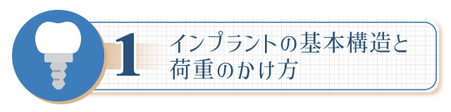 １、【インプラントの基本構造と荷重のかけ方】