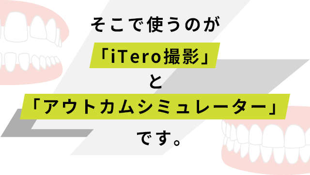 そこで使うのが「iTero撮影」と「アウトカムシミュレーター」です。