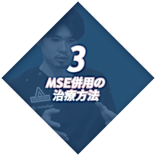 【3、MSE併用の治療方法】