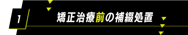 【1：矯正治療前の補綴処置】