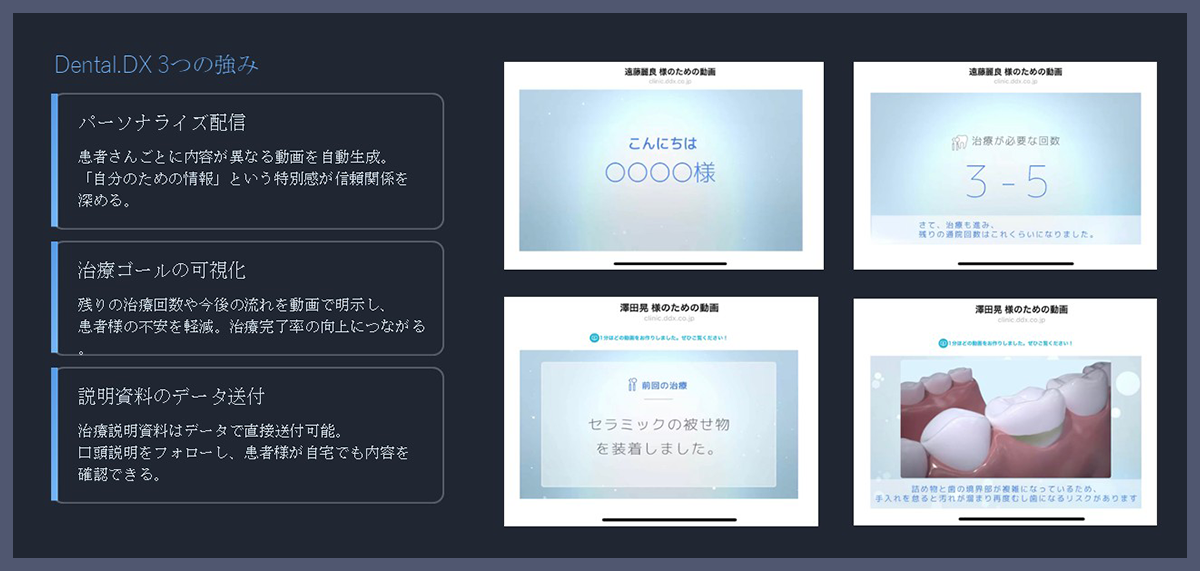 Dental DX 3つの強み