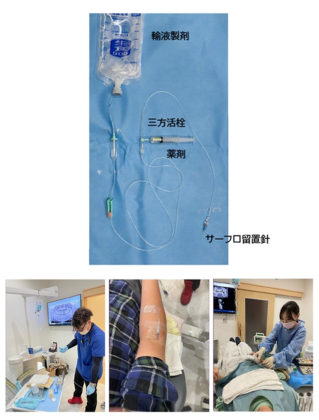 静脈内鎮静法の実際
