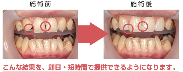 こんな結果を、即日・短時間で提供できるようになります。