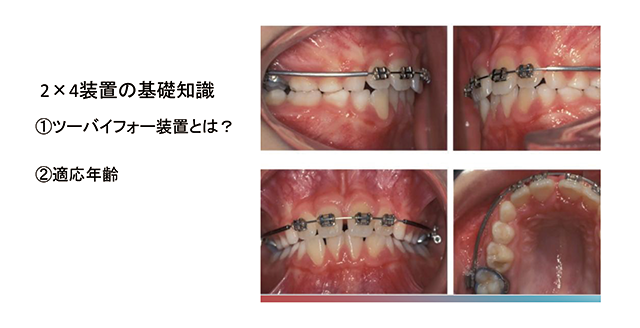 2×4装置の基礎知識