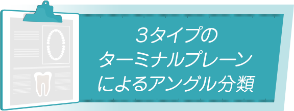 【３タイプのターミナルプレーンによるアングル分類】