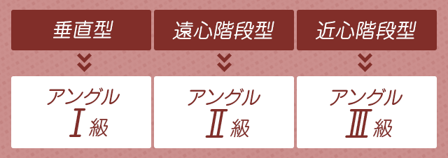 「垂直型→アングルⅠ級」「遠心階段型→アングルⅡ級」「近心階段型→アングルⅢ級」】