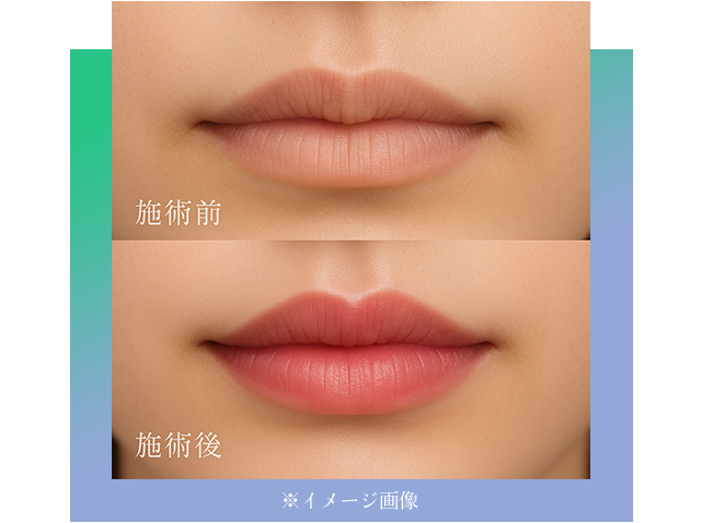 ※イメージ画像