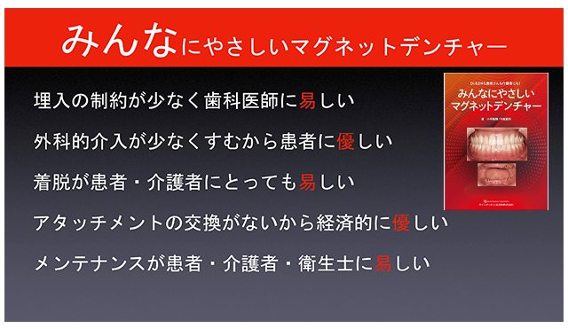 みんなにやさしいマグネットデンチャー