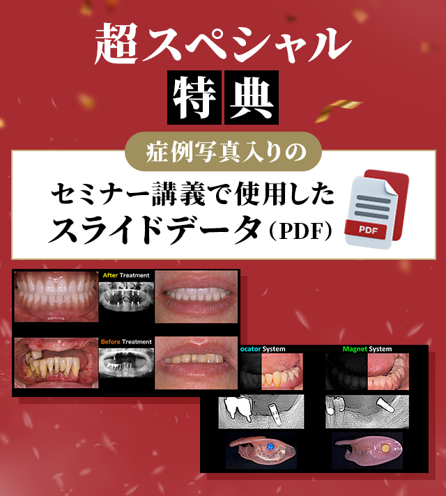 購入特典