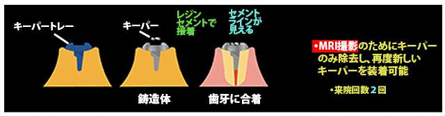 キーパー