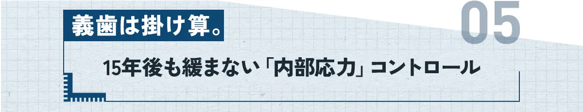 ⑤：義歯は掛け算。15年後も緩まない「内部応力」コントロール