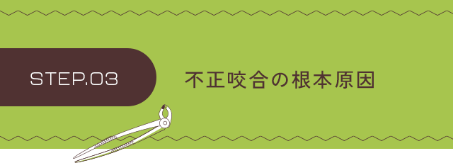【ステップ3：不正咬合の根本原因】