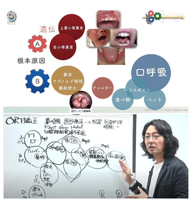 根本原因