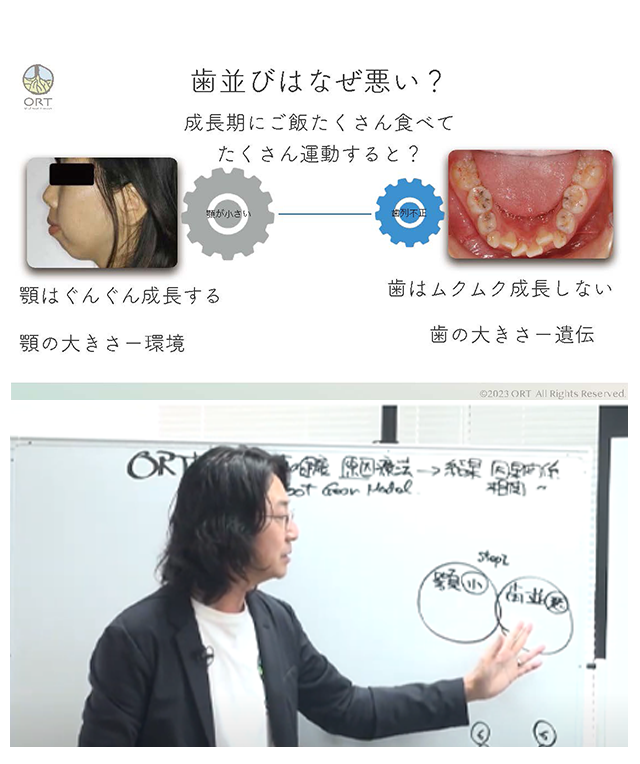 歯並びはなぜ悪い？