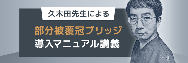 【久木田先生による部分被覆冠ブリッジ導入マニュアル講義】