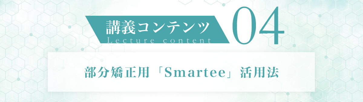 講義コンテンツ04 部分矯正用「Smartee」活用法