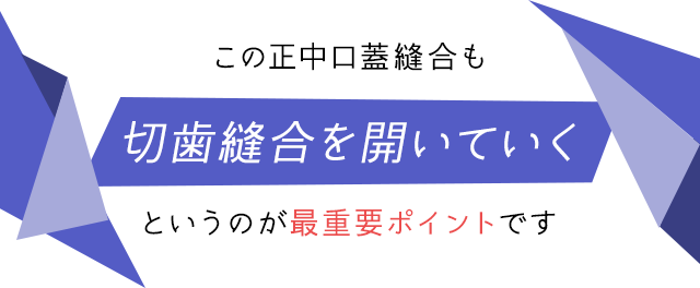 この正中口蓋縫合も切歯縫合を開いていくというのが最重要ポイントです。