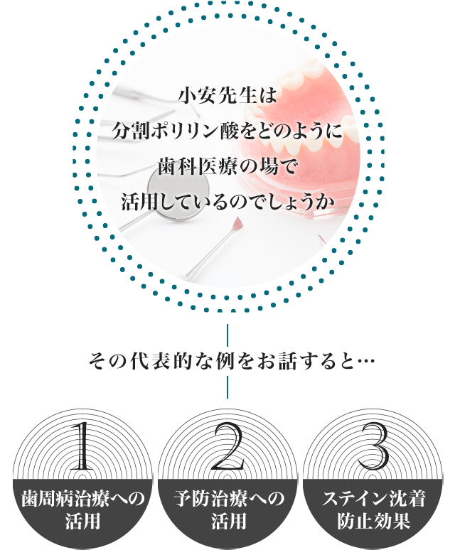 小安先生は分割ポリリン酸をどのように歯科医療の場で活用しているのでしょうか