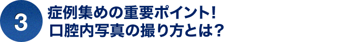 ③症例集めの重要ポイント！口腔内写真の撮り方とは？