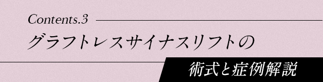 【グラフトレスサイナスリフトの術式と症例解説】