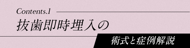 【抜歯即時埋入の術式と症例解説】