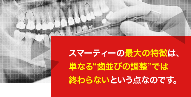 スマーティーの最大の特徴は、単なる“歯並びの調整”では終わらないという点なのです。
