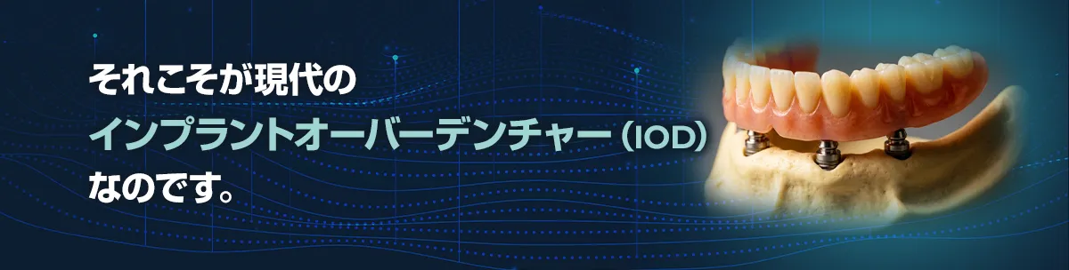 それこそが現代のインプラントオーバーデンチャー（IOD）なのです。