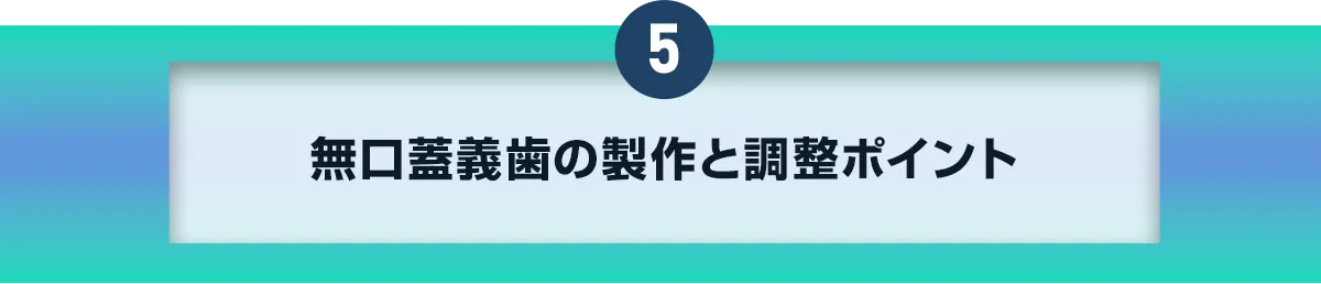 5無口蓋義歯の製作と調整ポイント