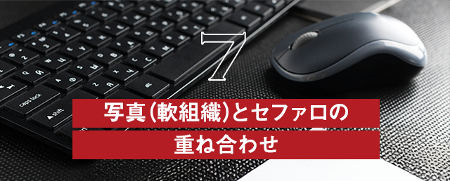 【写真（軟組織）とセファロの重ね合わせ】