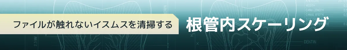 ファイルが触れないイスムスを清掃する根管内スケーリング