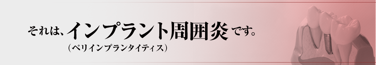 それは、「インプラント周囲炎（ペリインプランタイティス）」です。