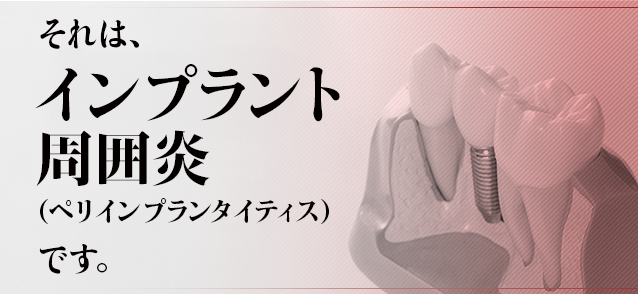 それは、「インプラント周囲炎（ペリインプランタイティス）」です。